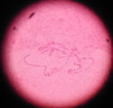 だ液腺染色体顕微鏡写真