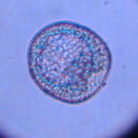 原腸胚初期